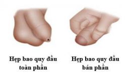 ban-hep-bao-quy-dau-la-gi-co-chua-duoc-khong