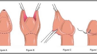 giai-dap-cat-bao-quy-dau-co-dau-khong