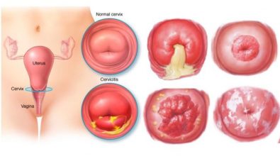 chua-viem-lo-tuyen-o-dau-ha-noi-10-dia-chi-co-bac-si-gioi-kham-chua