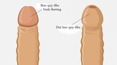 dai-bao-quy-dau-la-gi-nguyen-nhan-bieu-hien-va-cach-dieu-tri