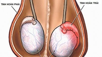 dau-tinh-hoan-trai-dau-hieu-nguy-hiem-nam-gioi-cho-nen-coi-thuong