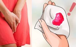 kinh-nguyet-ra-nhieu-nguyen-nhan-va-cach-chua-tri-nhu-the-nao