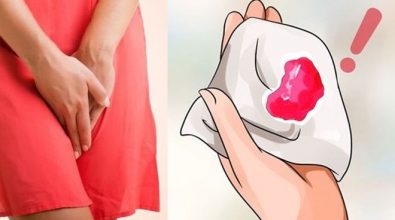 kinh-nguyet-ra-nhieu-nguyen-nhan-va-cach-chua-tri-nhu-the-nao