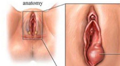 nguyen-nhan-khien-moi-be-bi-sung-chi-em-nao-cung-nen-biet