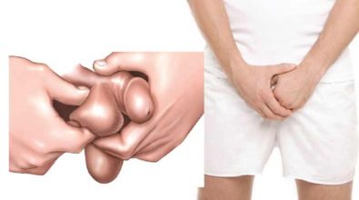 sung-vung-biu-co-sao-khong-cach-chua-nhu-the-nao