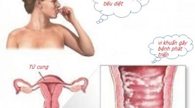 viem-am-dao-o-nu-gioi-nguyen-nhan-trieu-chung-va-cach-dieu-tri