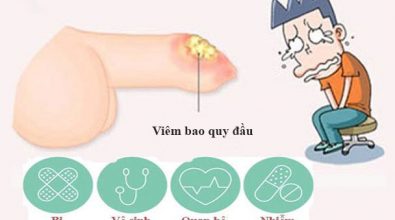 viem-bao-quy-daunguyen-nhan-trieu-chung-va-cach-dieu-tri-nhu-nao