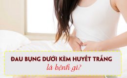 khi-hu-ra-nhieu-buon-non-va-dau-bung-duoi-can-canh-giac
