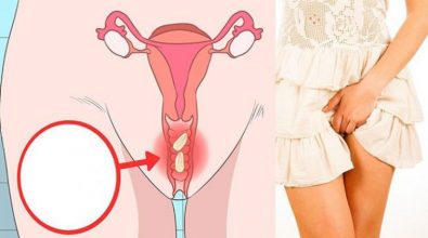 ngua-vung-kin-nu-va-cach-dieu-tri