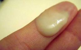 ngua-vung-kin-va-ra-dich-mau-xanh-von-cuc-nhu-ba-dau