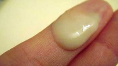 ngua-vung-kin-va-ra-dich-mau-xanh-von-cuc-nhu-ba-dau