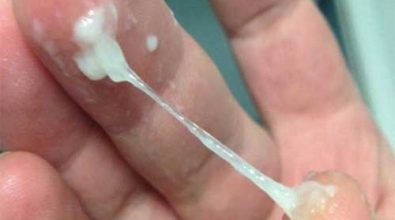 viem-am-dao-ra-dich-mau-xanh-von-cuc