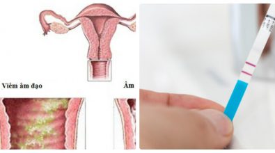 viem-am-dao-thu-que-co-chinh-xac-khong